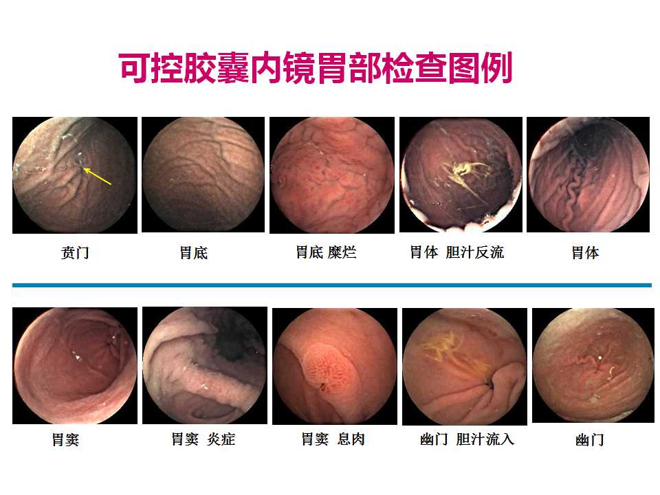 幻灯片13